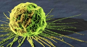 komórka nowotworowa